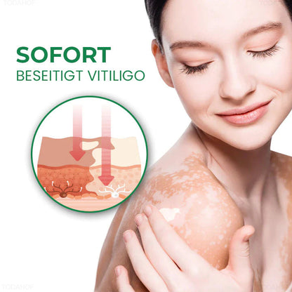 TODAHOF™  PRO Vitiligo Repair Revitalisierende Creme